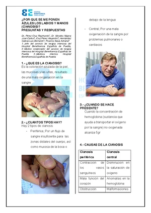 Cianosis: DESCUBRE su DEFINICIÓN y CAUSAS esenciales