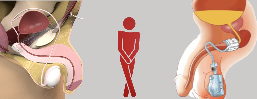 CUANTOS ESFINTERES HAY EN EL CUERPO HUMANO DESCÚBRELOS