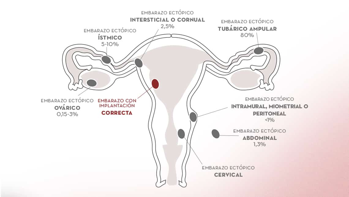 Embarazo: DEFINICIÓN, TIPOS y CARACTERÍSTICAS CLAVE
