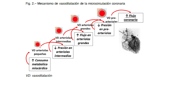 ISQUEMIA: Definición y Concepto Esencialmente Clave