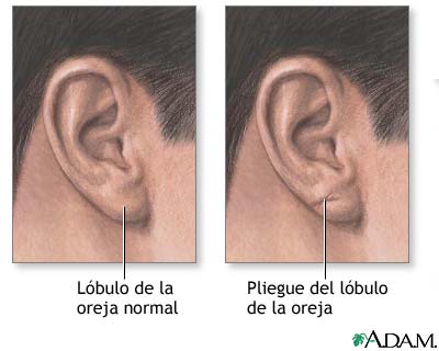 LOBULOS: Qué es y Importancia del LÓBULO de la OREJA