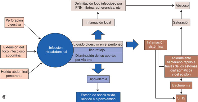 PERITONITIS: Definición, Concepto y Claves Esenciales