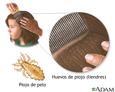 PIOJO: Definición, USOS y datos interesantes que no conocías