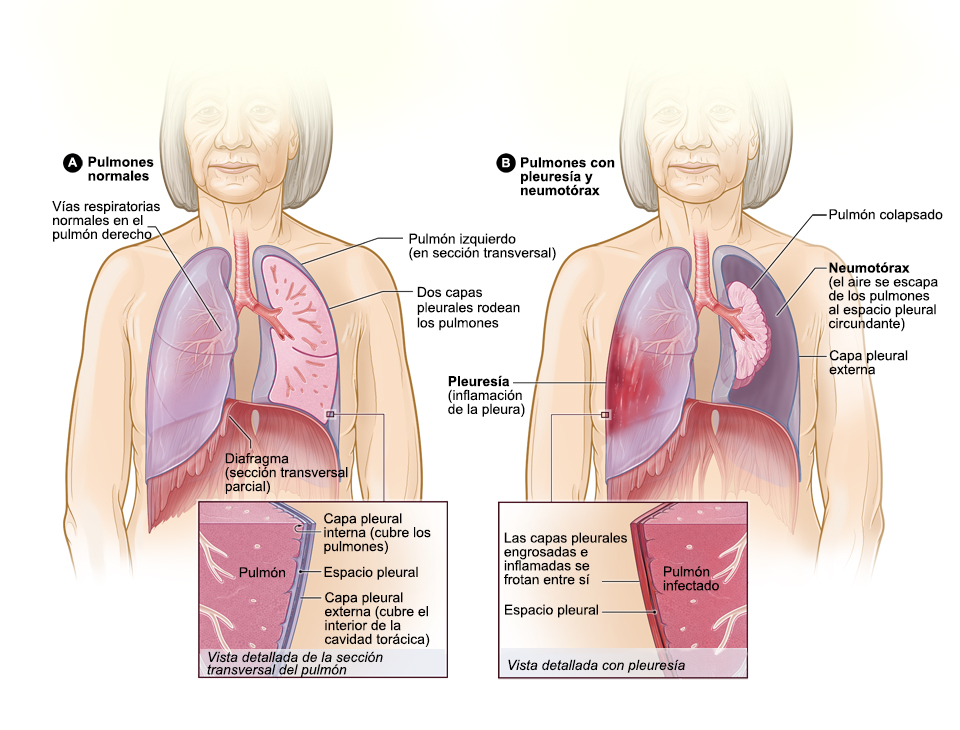 PLEURA: Definición y Concepto de la PLEURA PULMONAR