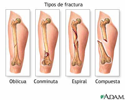Qué es el hueso cúbito y cómo se clasifica esencialmente