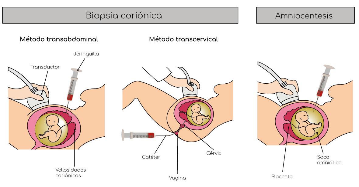 Qué es el letargo Definición y significado claros explicados