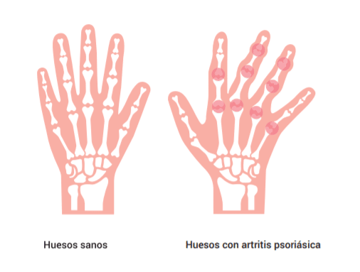 Qué es el PIRISIS y cuál es su definición y concepto esencial