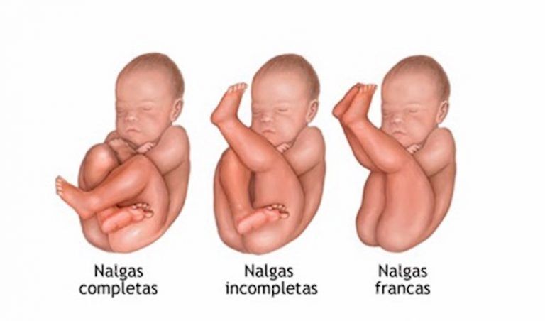 Qué es el podálico y cómo se define su concepto esencial