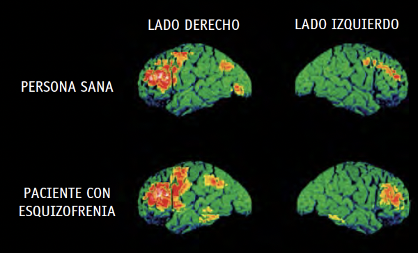 Qué es la conciencia y cuáles son sus sinónimos más relevantes