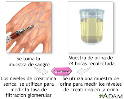 Qué es la creatinina y por qué es importante para la salud