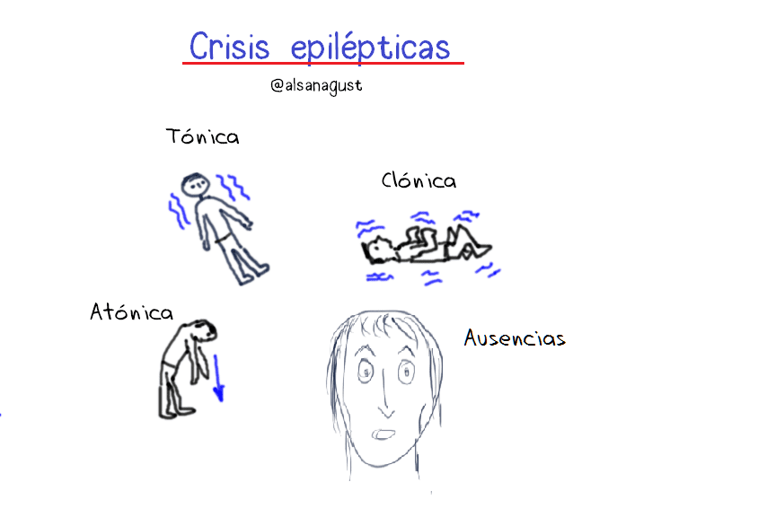 QUÉ ES LA DISMINUCIÓN Y CUÁL ES SU SINÓNIMO EN 30 SEGUNDOS