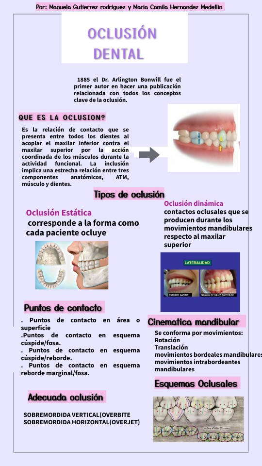 Qué es la oclusión y cuáles son sus tipos y conceptos clave