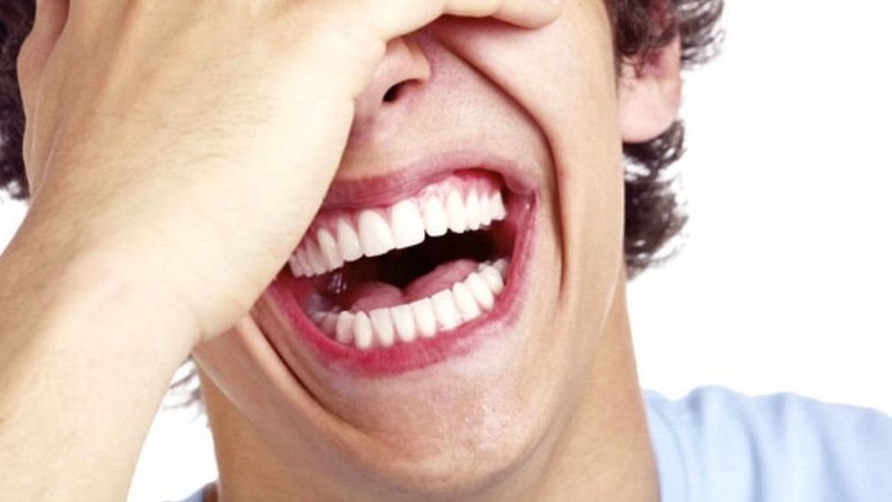 Qué es la RISA y por qué nos provoca una reacción de REIR