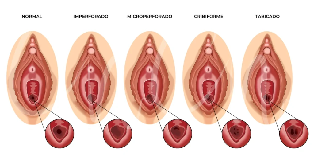 Qué es la virginidad y cuál es su significado y definición