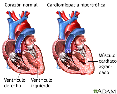 Qué es MIODCARDIO y cuáles son sus conceptos fundamentales