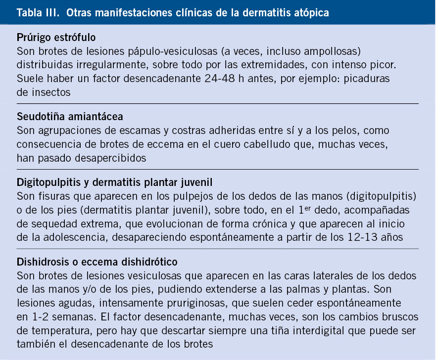 Qué es un esferoide, cómo se clasifica y cuál es su valoración
