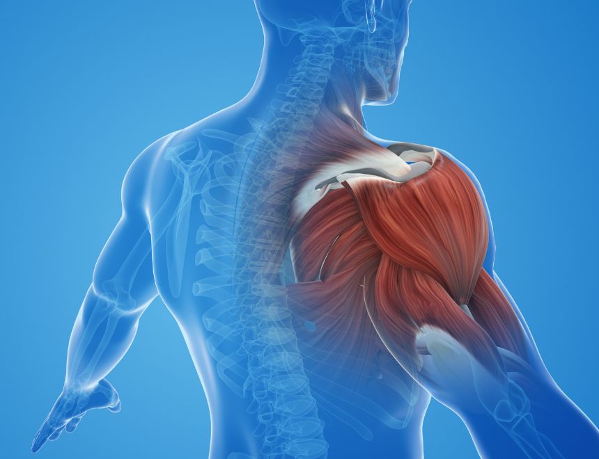 Qué es una contractura y cuál es su impacto en la salud
