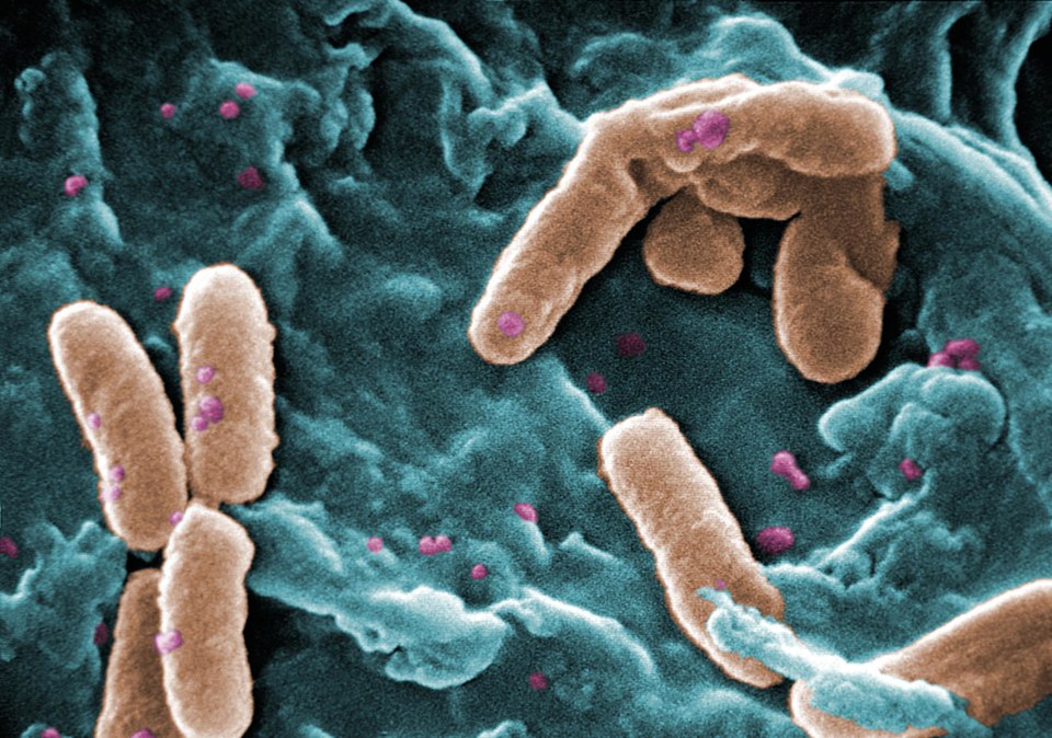Qué son las Pseudomonas y cuáles son sus características clave