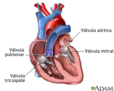SOPLIDO en Medicina: Definición y Concepto Esencial