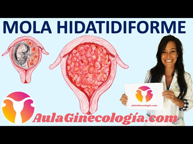 TROFOBLASTO ENVOLVENTE: Definición y Concepto Clave